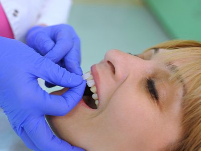 Woman getting veneers