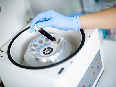 Gloved hand placing blood in centrifuge