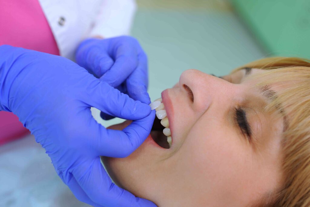 Woman getting veneers